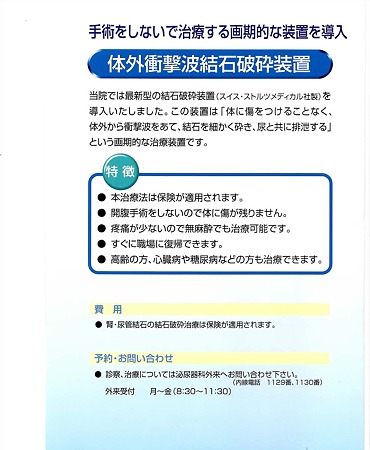 体外衝撃波結石破砕装置